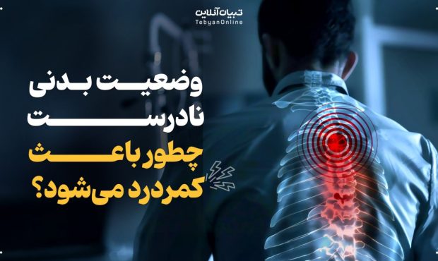 چگونه وضعیت بدنی نادرست موجب کمردرد میشود؟ چگونه وضعیت بدنی نادرست موجب کمردرد میشود؟